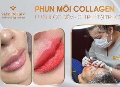 Có Nên Làm Phun Môi Collagen? Ưu Nhược Điểm và Chi Phí Tại TPHCM